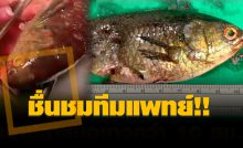 ผ่าตัดปลาหมอติดคอหอย