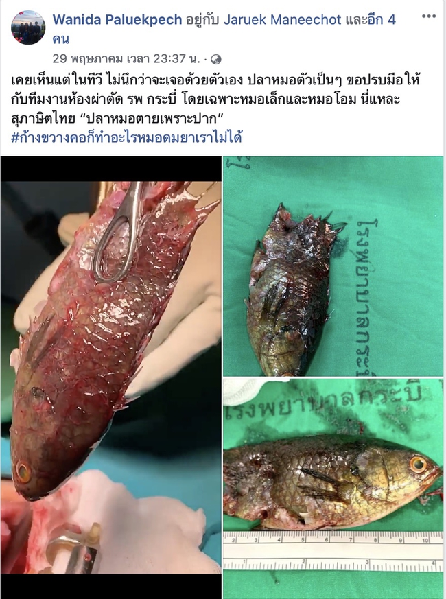 ผ่าตัดปลาหมอติดคอหอย