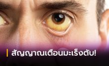 สัญญาณเตือนโรคมะเร็งตับ