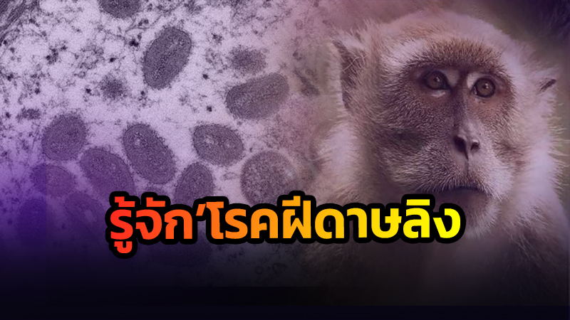 รู้จัก ‘โรคฝีดาษลิง’ ทำไมคนเกิดหลังปี 2523 เสี่ยงกว่ากลุ่มอายุอื่น